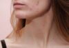 skin issues